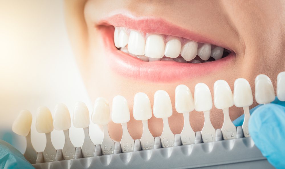 Top Reasons to Consider Cosmetic Dentistry